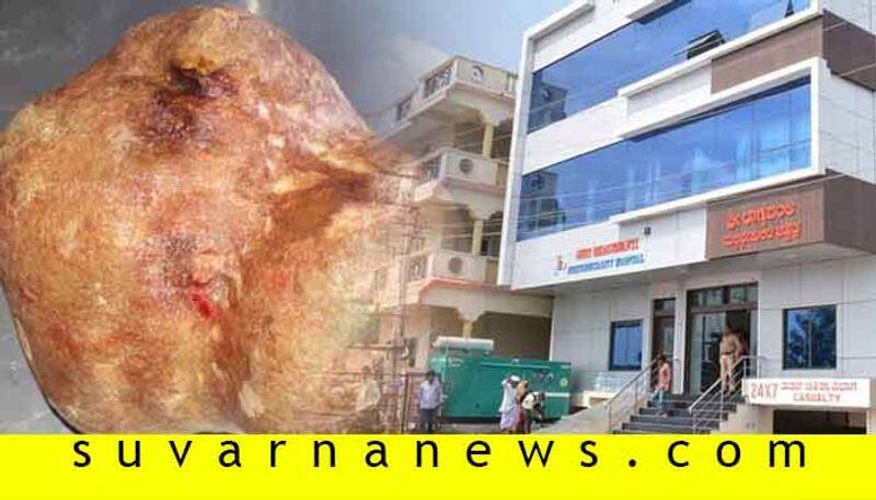 Doctors Succesful Operation to Patient in Vijayapura