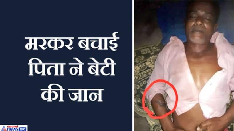 अपनी जान देकर बेटी काे मौत के मुंह से खींच लाया पिता, बिजली के तारों से चिपक गई थी वो