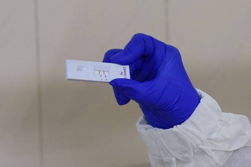 Karnataka: You can now get your COVID results in 10 minutes with Mysore University new testing kit