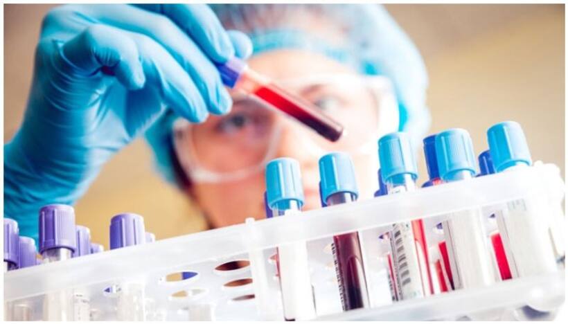Karnataka: Pooling of COVID 19 samples allowed in districts with less than 5% positivity rate