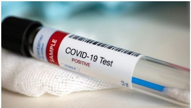 COVID-19 tests in Karnataka cross 90 lakh mark on Wednesday -ymn