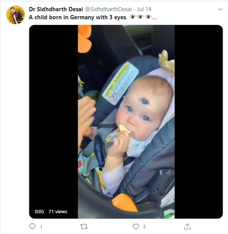 Edited Clip Viral As Three Eyed Baby Born