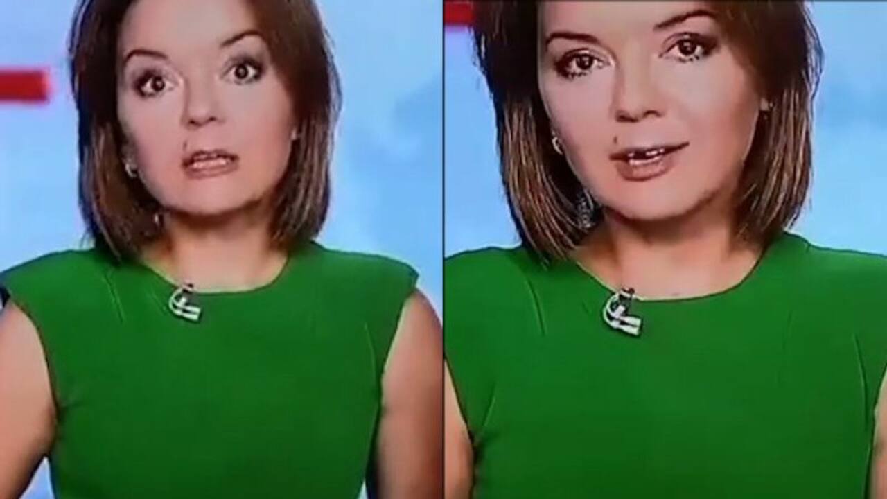 Watch: Journalist's front tooth falls out during live broadcast