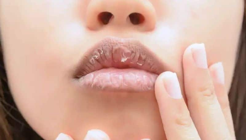 lip care tips dark lips from smoking try these remedies in tamil mks