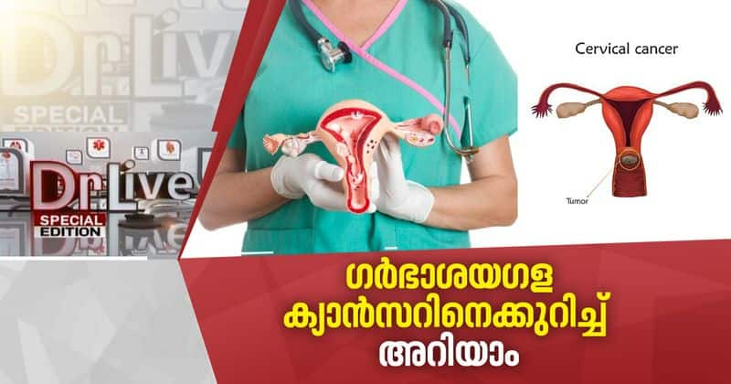 cervical cancer Doctor live