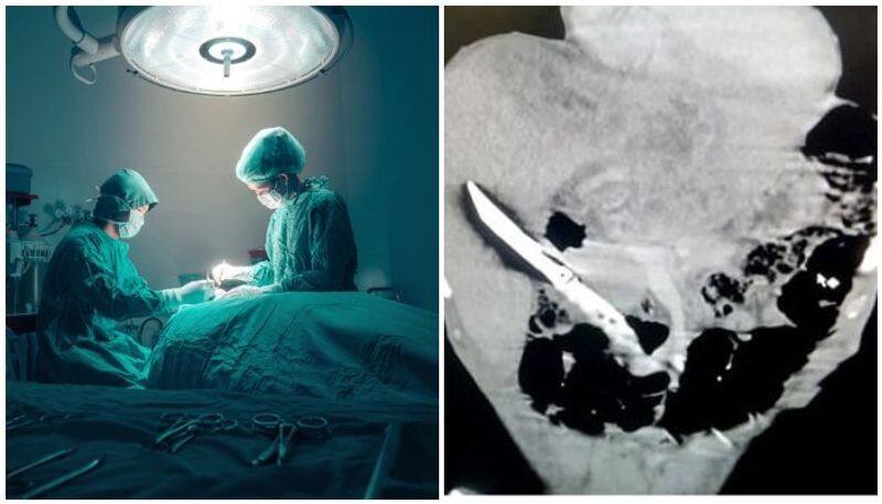 Man who swallowed knife lived with it for over a month; doctors successfully remove sharp object