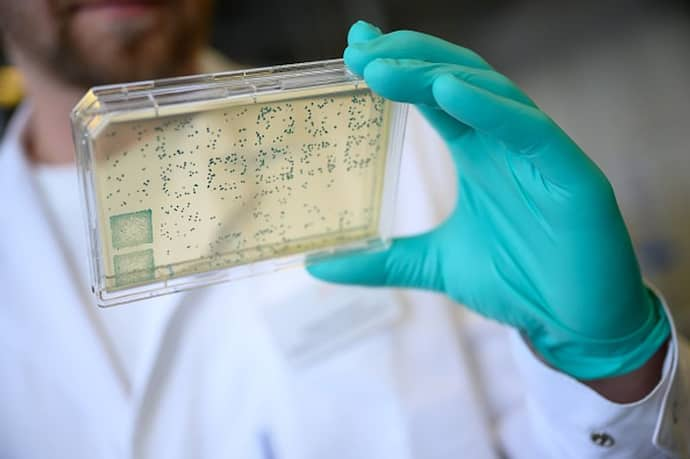 a man is looking at a carrier with bacteria from which DNA and subsequently RNA is obtained