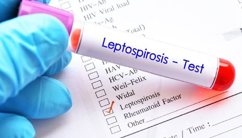 man dies due to leptospirosis in thiruvananthapuram