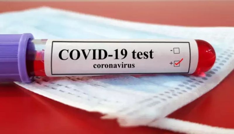 1019 new coronavirus cases on august 8 in karnataka gvd