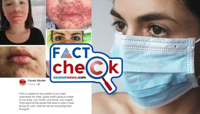 Fact Check on Wearing Face Masks causes Skin diseases