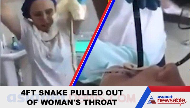 Doctors pull out snake from woman's throat; video goes viral - gps