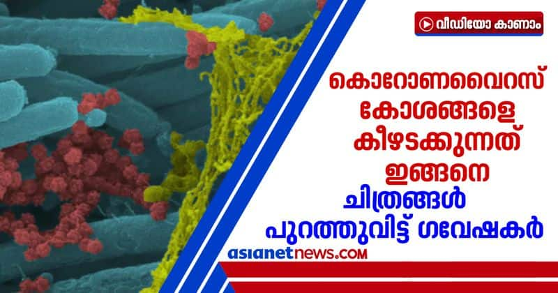 Scientists Publishes macroscopic Images Of Coronavirus Infecting Respiratory Cells