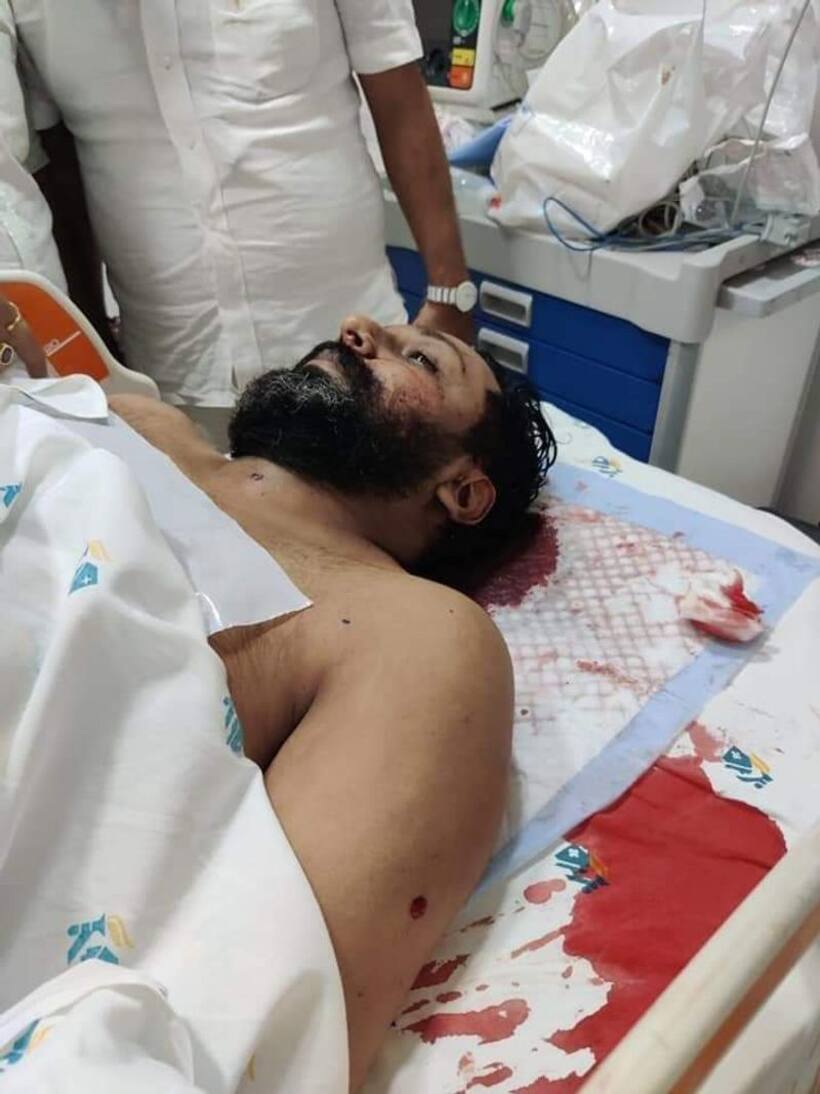 West Bengal: CID arrests 2 for BJP leader Manish Shukla's murder; cops suspect old rivalry