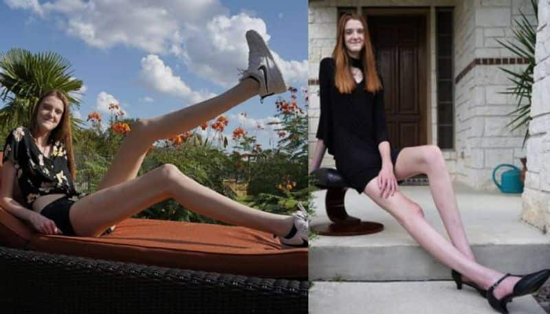 girl breaks Guinness World Record for longest legs