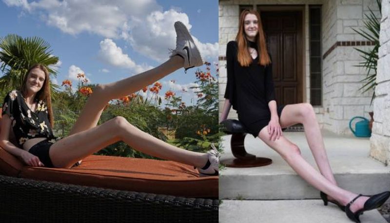 girl breaks Guinness World Record for longest legs