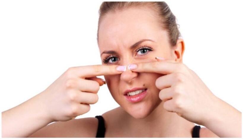 How to remove black heads using home remedies