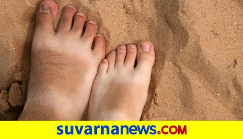 From tomato to cucumber; 5 easy yet effective home remedies to remove sun tan