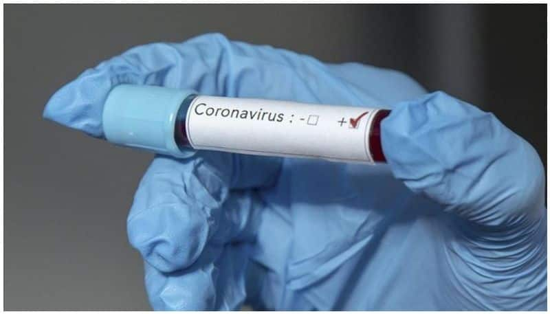 Dont take corona virus lightly Some things to know