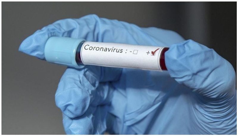 Dont take corona virus lightly Some things to know