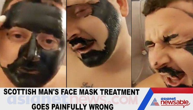 Scottish man's face mask treatment goes painfully wrong-tgy