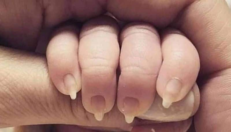 mother slammed for doing manicure for infant