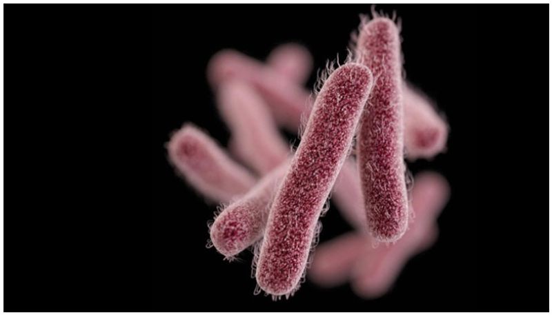 what are the symptoms of Shigella