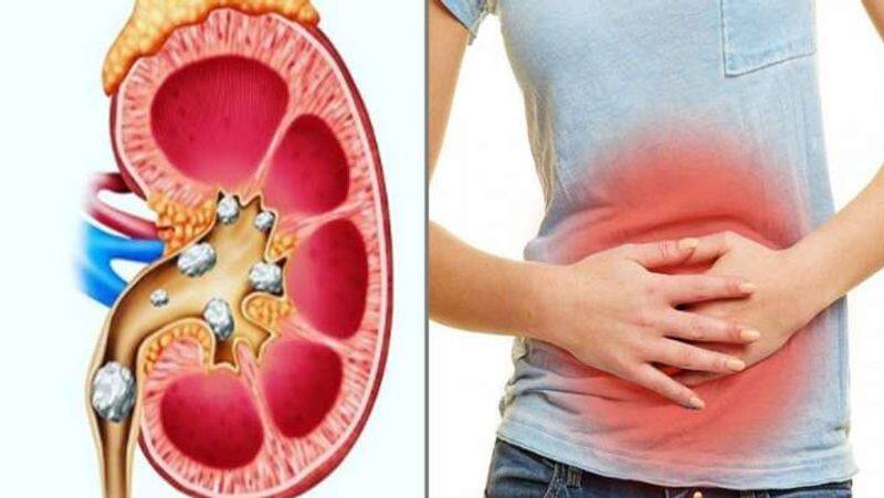 bladder cancer symptoms tamil 