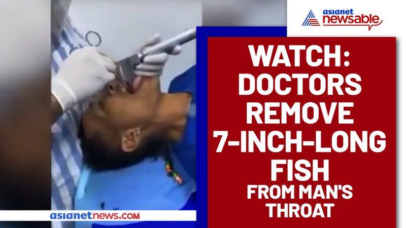 Seven inch fish removed from man's throat; video goes viral - gps