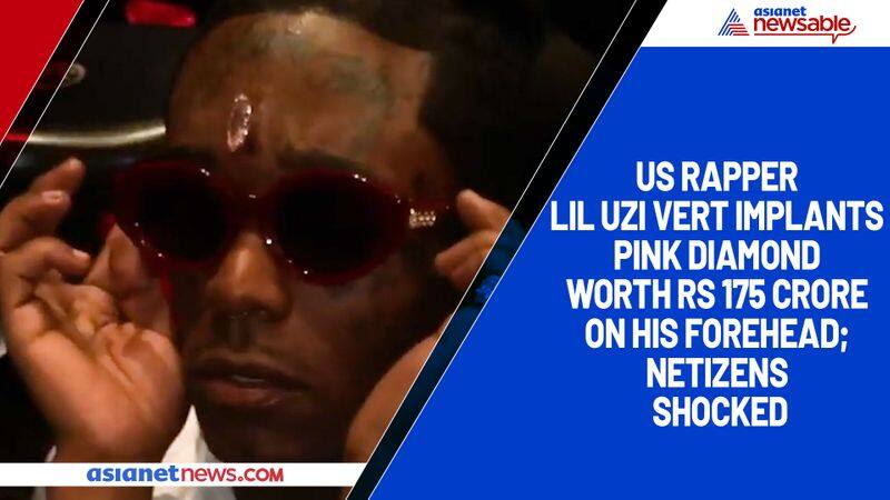 US rapper Lil Uzi Vert implants pink diamond worth Rs 175 crore on his forehead; netizens shocked-TGY