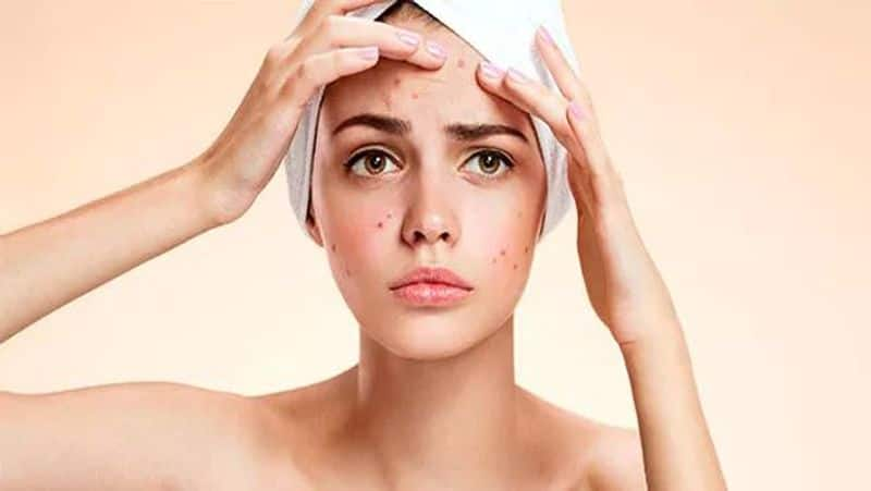 beauty secrets for sensitive skin