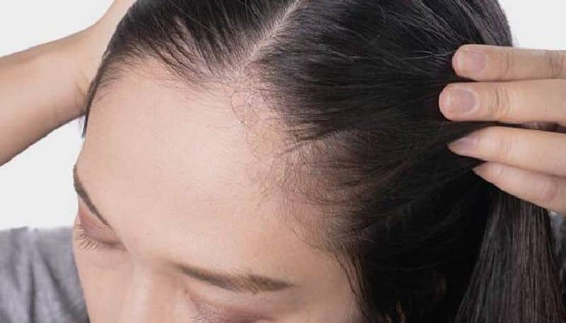 tips for hair thinning