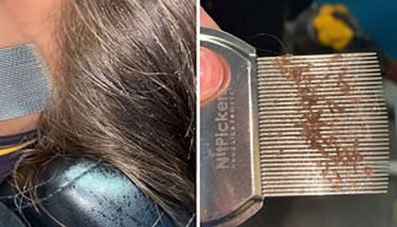 Nauseating moment mother runs a comb through a young girl's hair and discovers an insane lice infestation