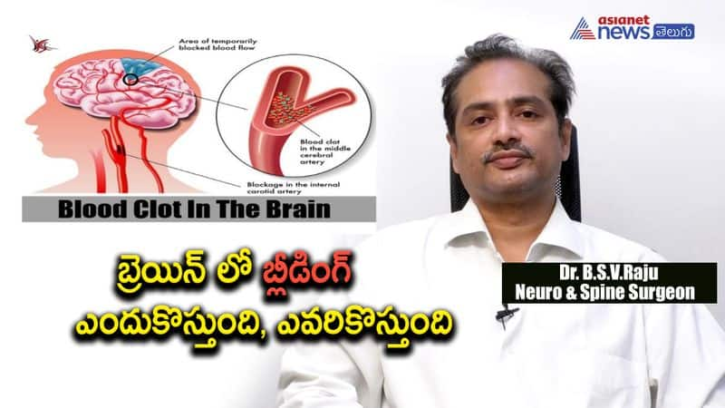 reasons for brain hemorrhage, diagnosis and cure