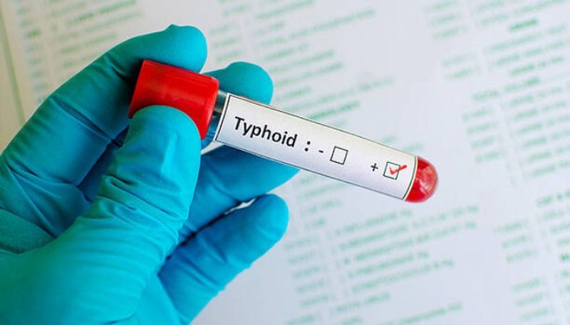 Fever among kids, typhoid keep doctors busy in Chennai