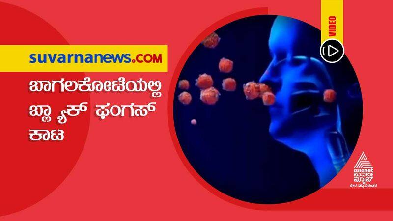 Nine are attacked with Black Fungus in Bagalkot hls