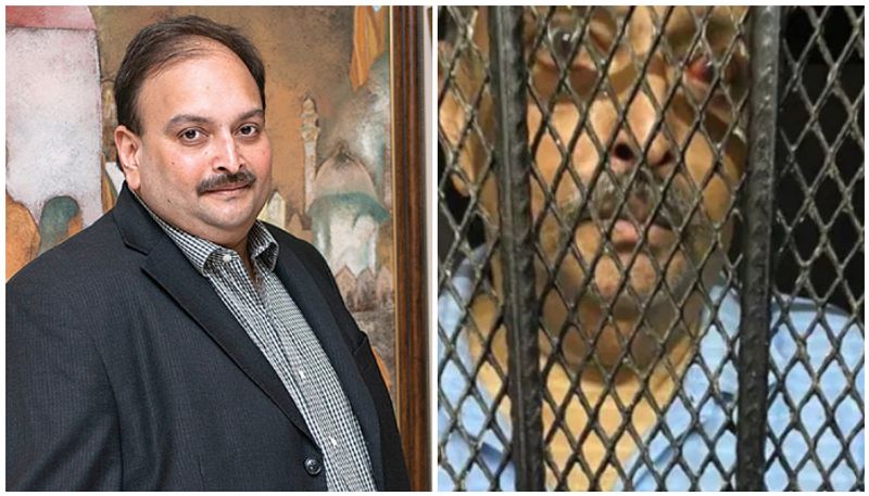 Mehul Choksi pictures from Dominica surface show him with injury marks pod