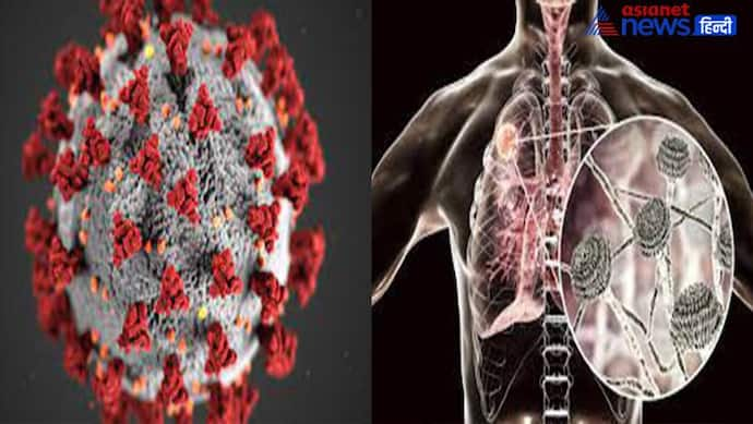 नए फंगल इन्फेक्शन Aspergillosis के मरीजों में दिखते हैं ये 5 लक्षण, तुंरत करें इलाज