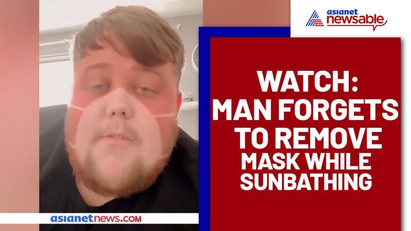 Man Forgets To Take Face Mask Off While Sunbathing; Learns Lesson A Hard Way - gps