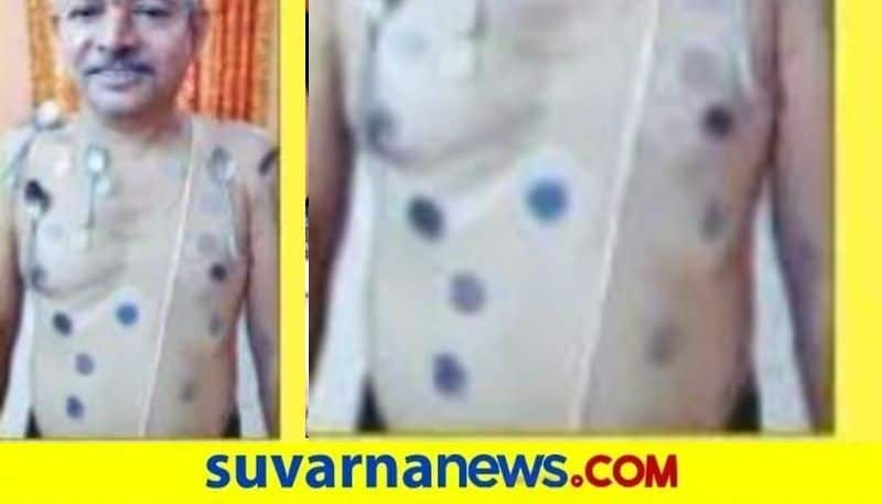 Udupi Man Gets Magnetic Power After Covid Vaccine Here is All You Must Know hls