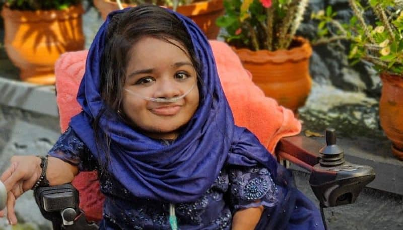 latheesha ansari who had rare bone disease dies at hospital