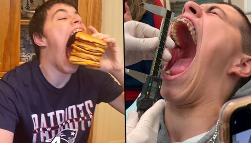 US Teenager sets Guinness World Record For Largest Mouth Gape; Watch Video