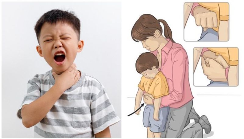 Food stuck in kids throat What to do and spotting an emergency