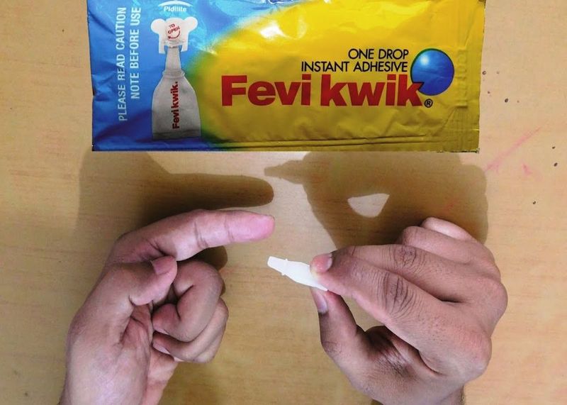 Hospital uses Fevikwik instead of stitches for childs head injury in Telangana Vin