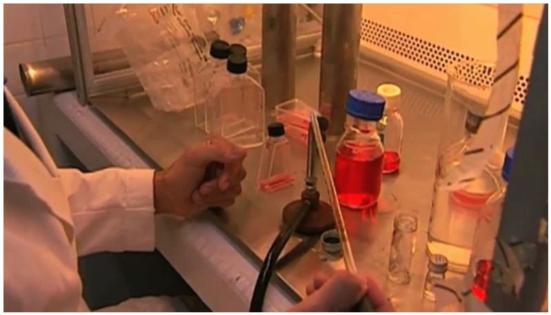 lab for nipha virus test in kozhikode medical college