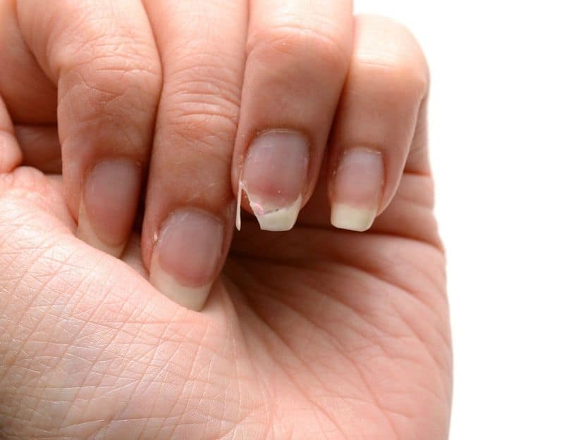 Tips to Prevent Nails spilt