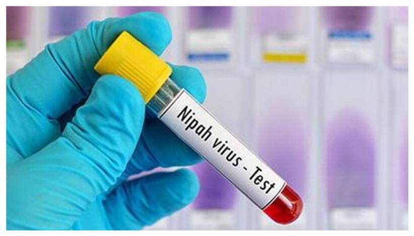 Nipah: నిర్దిష్టమైన మందులు, వ్యాక్సిన్లు లేని 'నిపా వైర‌స్' ల‌క్ష‌ణాలు ఇవే..