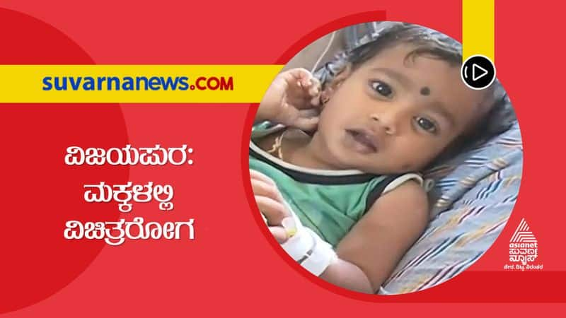 Vijayapura Kids cured from Dengue having skin allergy and tiredness hls