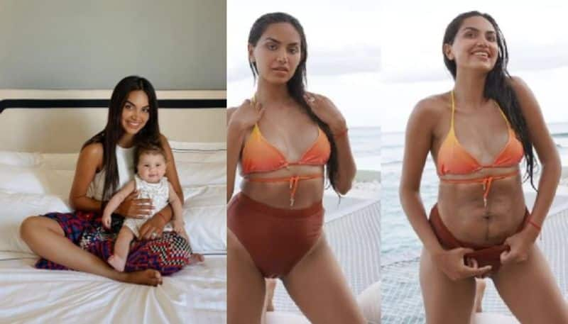 Influencer Shows Her Postpartum Body With Pride