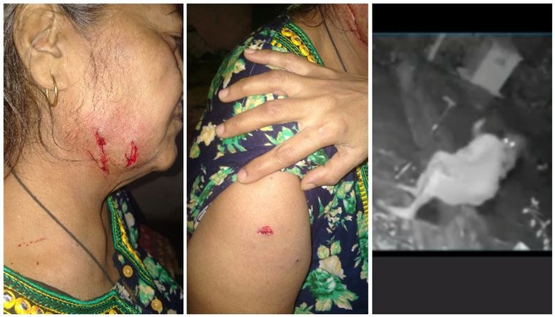 woman attacked by leopard in mumbai