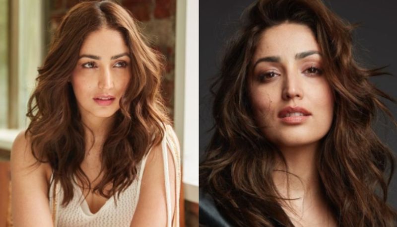 Yami Gautam reveals her incurable skin condition